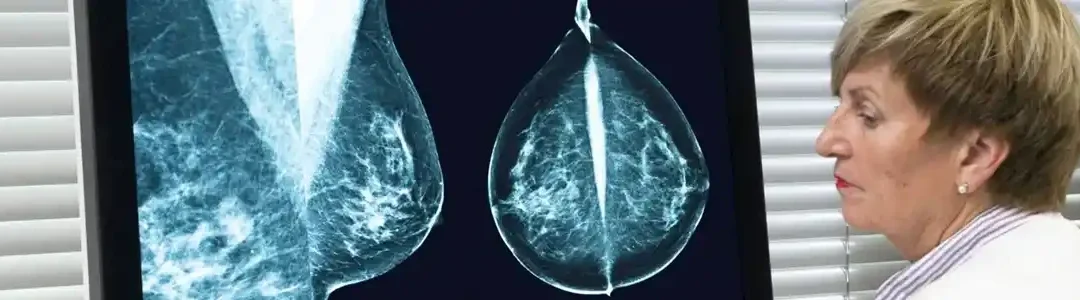 EGT and ScreenPoint Medical at the Breast Imaging 1st Annual Meeting 2025