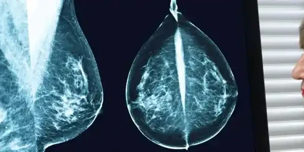 EGT and ScreenPoint Medical&hellip;