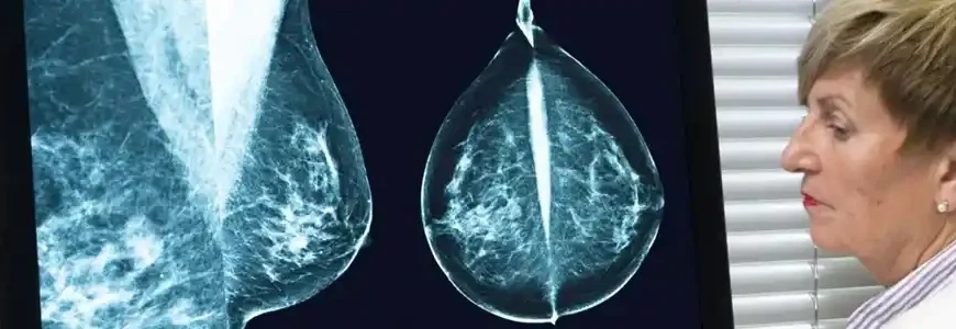 EGT and ScreenPoint Medical&hellip;